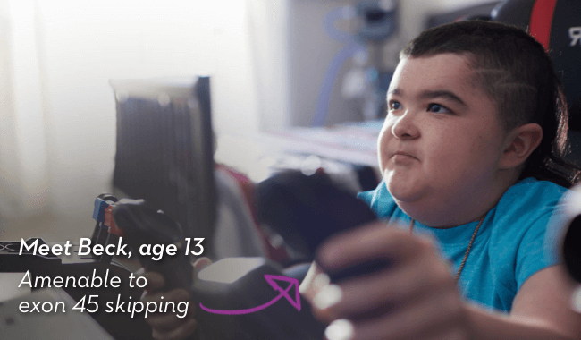 Meet Beck, age 13. Amenable to exon 45 skipping